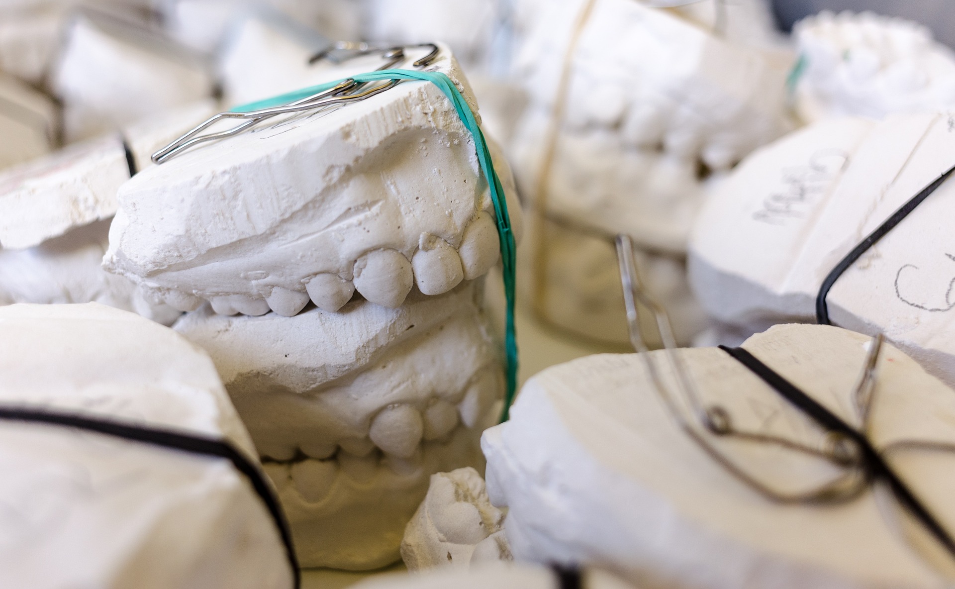 Plaster models poured at an orthodontic laboratory.