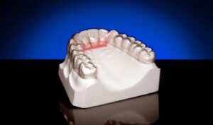 An orthodontic retainer with teeth
